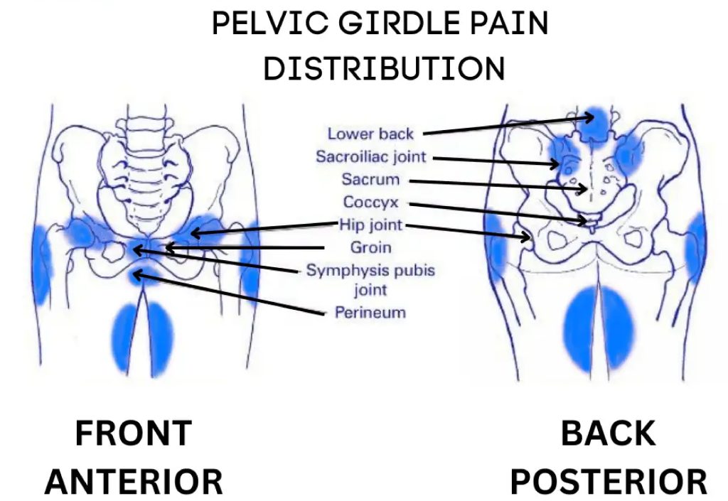 Pregnancy Related Pelvic Girdle Physiotherapy Brisbane - articulate.